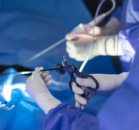 Intra Uterine Insemination (IUI)